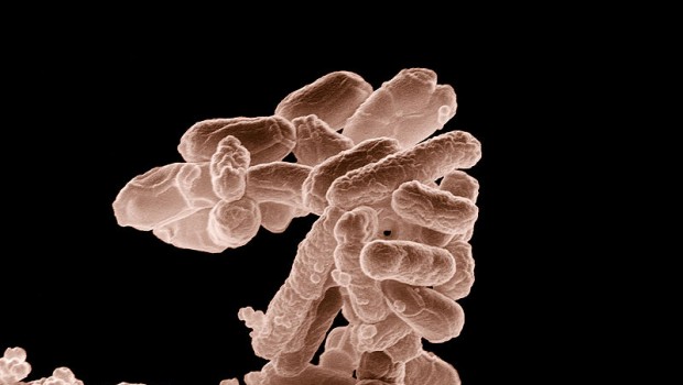 2011年德國大腸桿菌疫情 —（1）大腸桿菌與變異 (E. coli &O104:H4)