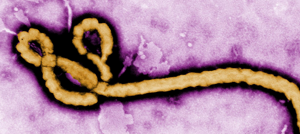 伊波拉病毒（Ebola virus）—病毒的分類與特徵（上）