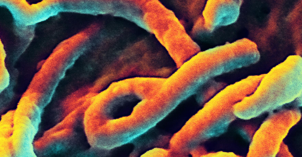 伊波拉病毒（Ebola virus）—病毒的防制